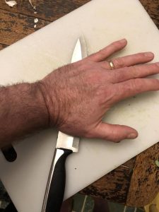 Palm down on knife and garlic cloves.